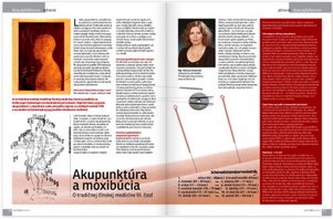 Akupunktúra a moxibúcia