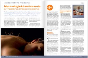 Neurologické ochorenia a TČM